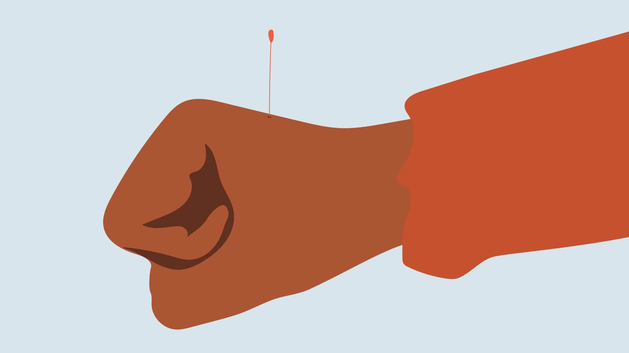 Here Is How Acupuncture Can Help You Manage Work-Related Stress