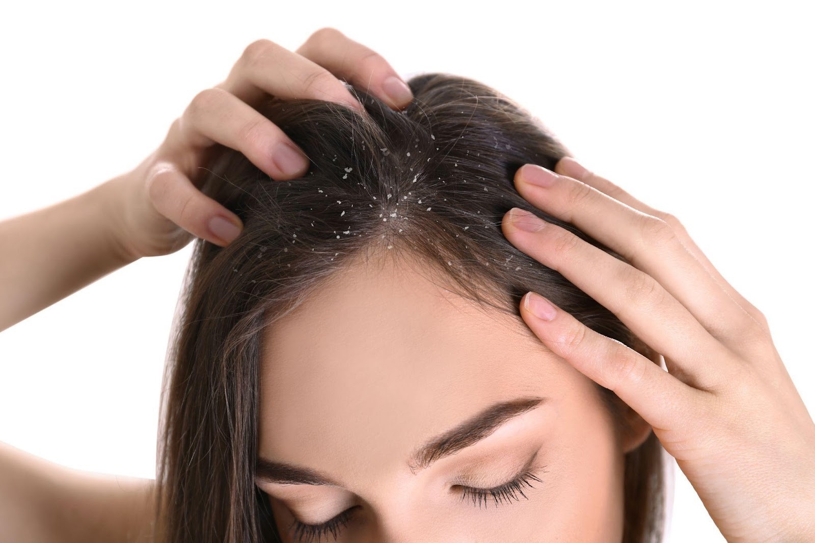 The Best Hair Oil For Dandruff