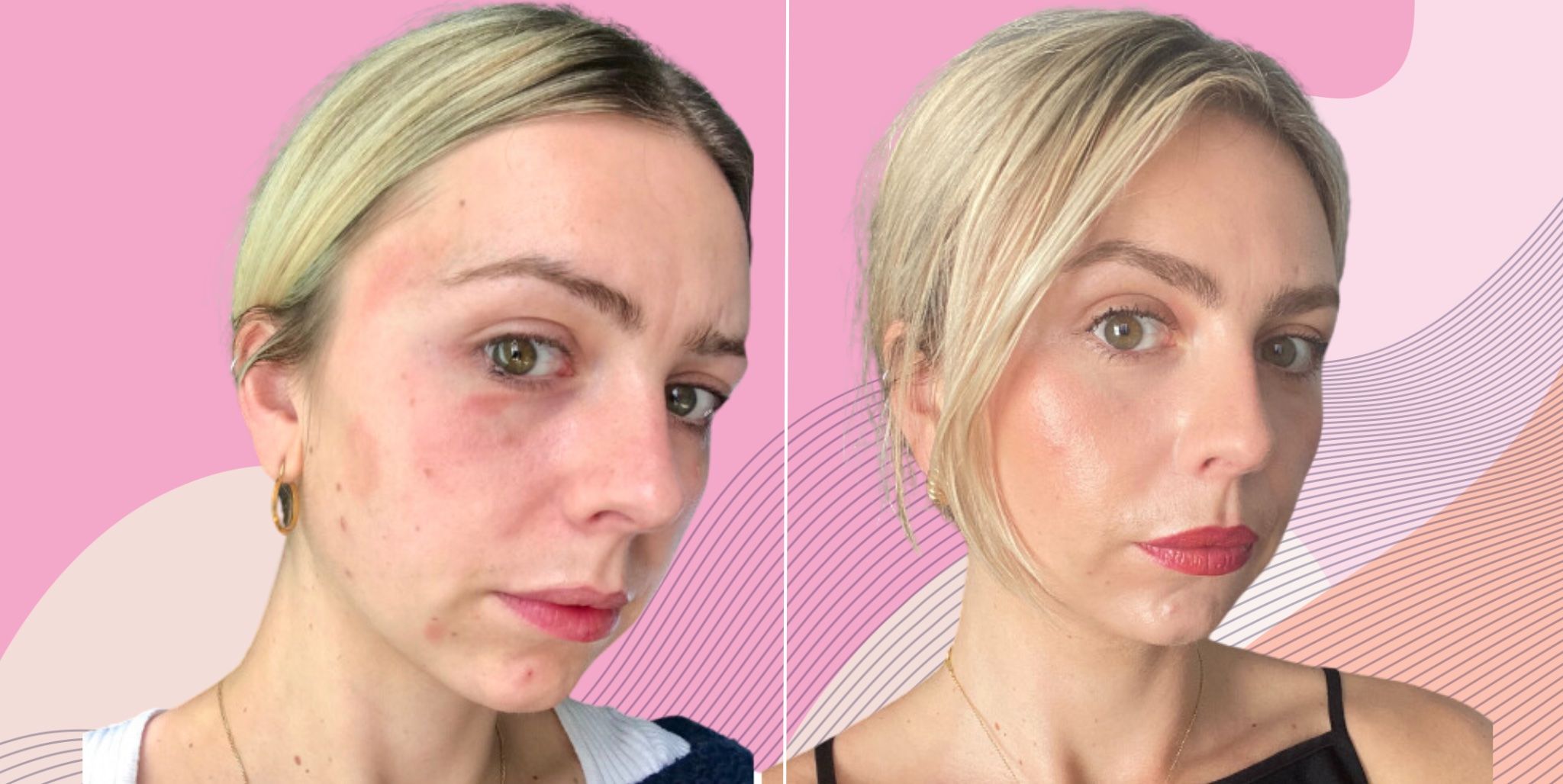 Skincare Through the Decades: What to Focus on in Your 20s, 30s, 40s, and Beyond