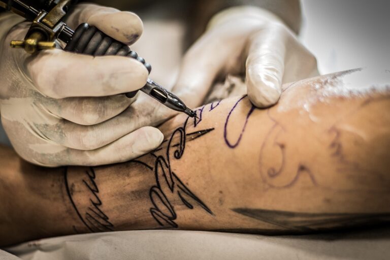 Can You Remove Colored Tattoos? Here’s the Truth