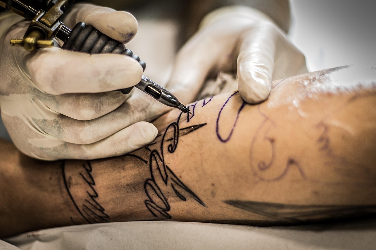 Can You Remove Colored Tattoos? Here’s the Truth